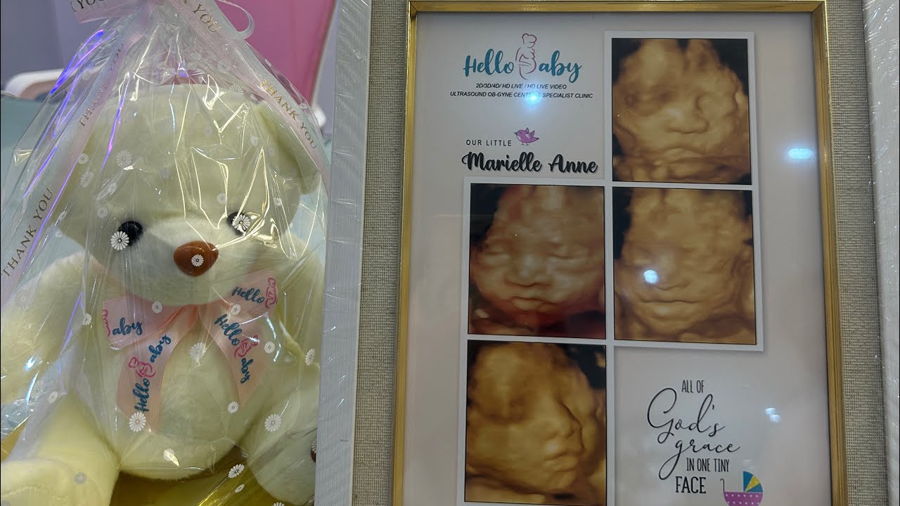 Hello Baby 4d Ultrasound at 27 weeks - YouTube