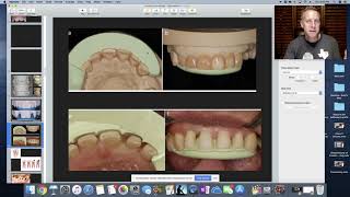 Wax up. Education for dental staff.