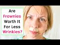 Frownies - Worth It For Less Wrinkles?