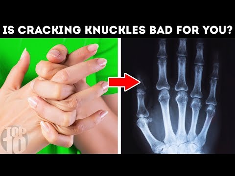 What Happens When You Crack Your Knuckles?