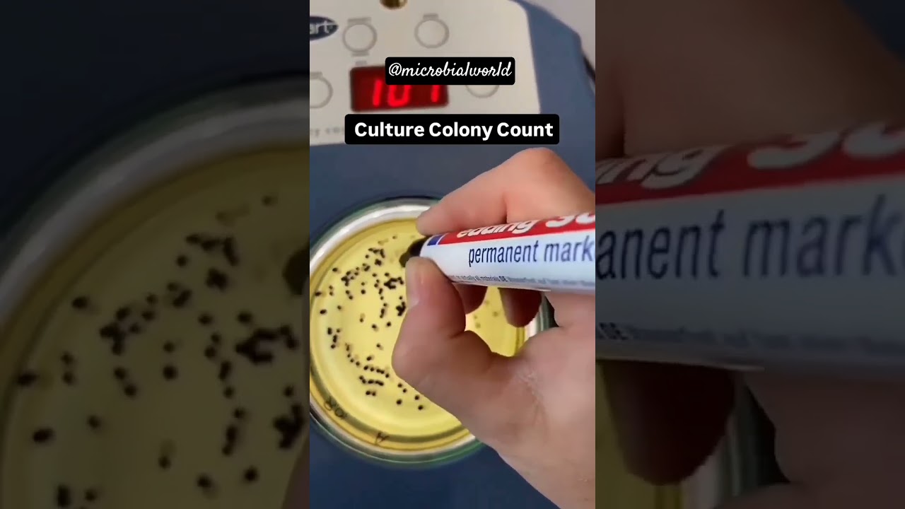 Culture colony counter🧫 