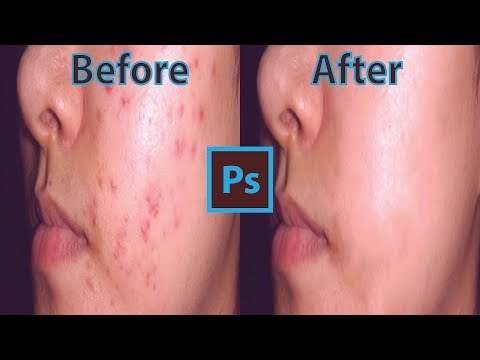 Photoshop CC Tutorial : Just in  minute Quickly Smooth Skin and Remove Blemishes & Scars