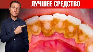 Зубной налет и зубной камень? Лучшее средство! Сделайте сами🙌