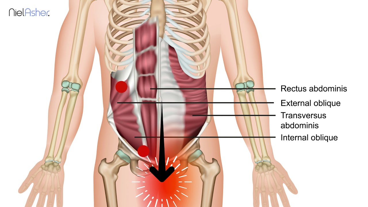 Oblique Muscles Trigger Point Anatomy Youtube