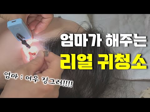 My Mom Cleaned My Ears