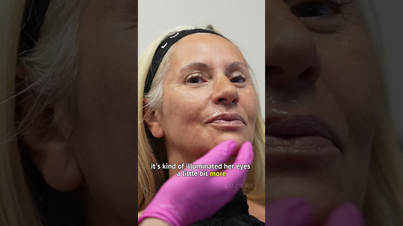 A full face transformation? Look at what Anti-Wrinkle & Filler treatments can do 😍
