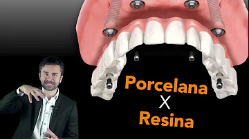 Quanto custa implante de 1 dente?