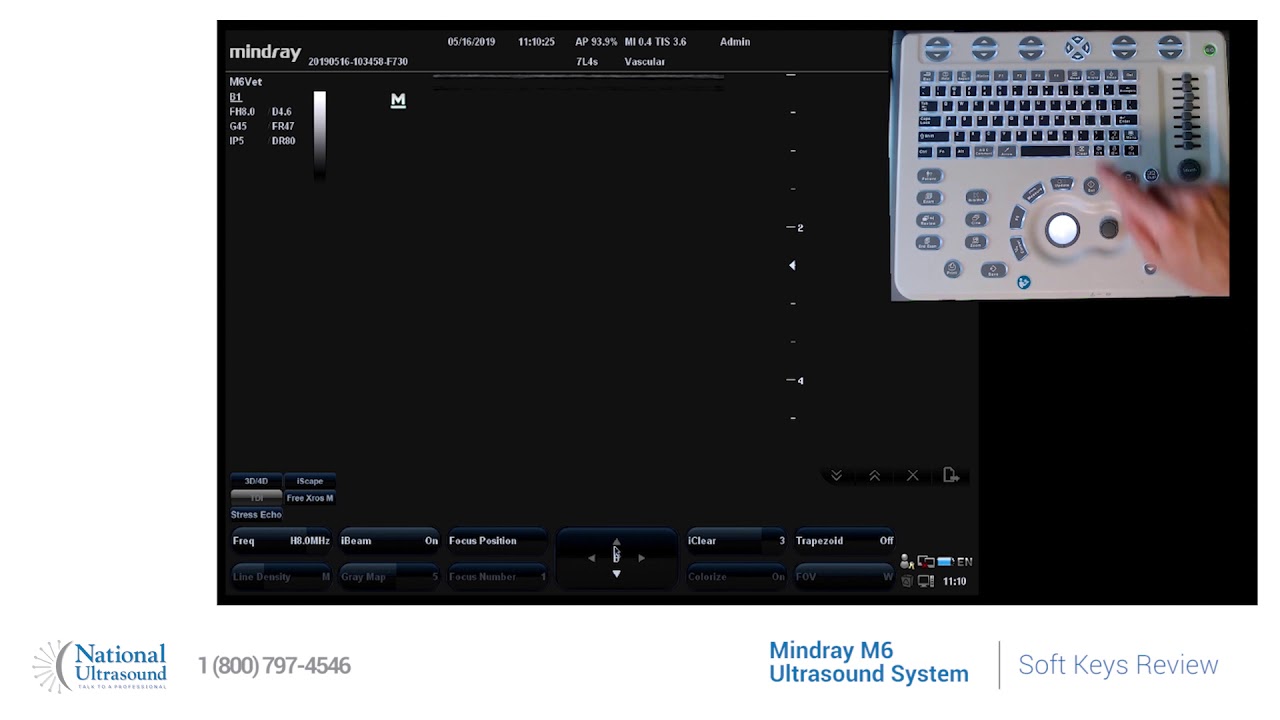 Mindray M6 Ultrasound Soft Keys Review