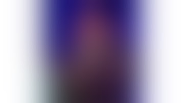 Robotic TAPP Left Inguinal hernia   (showing port placement)