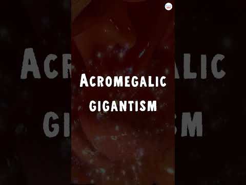 Video: 3 Cara Mendiagnosis Akromegali