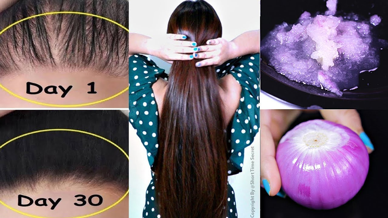 1 Week Challenge - Apply Onion Paste on your Thin Hair and your Hair Will Never Stop Growing