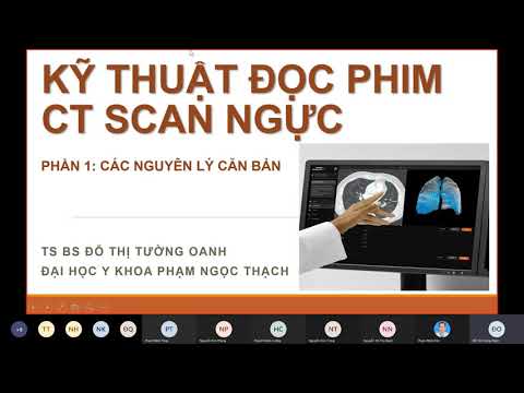 Video: Cách đọc CT Scan: 8 bước (có Hình ảnh)
