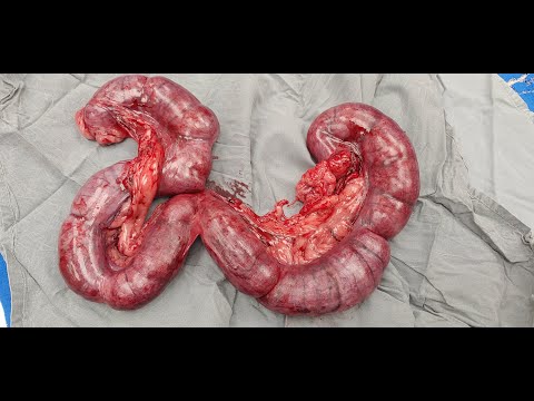 Video: Pyometra - Dev - Thickening Ntawm Uterus