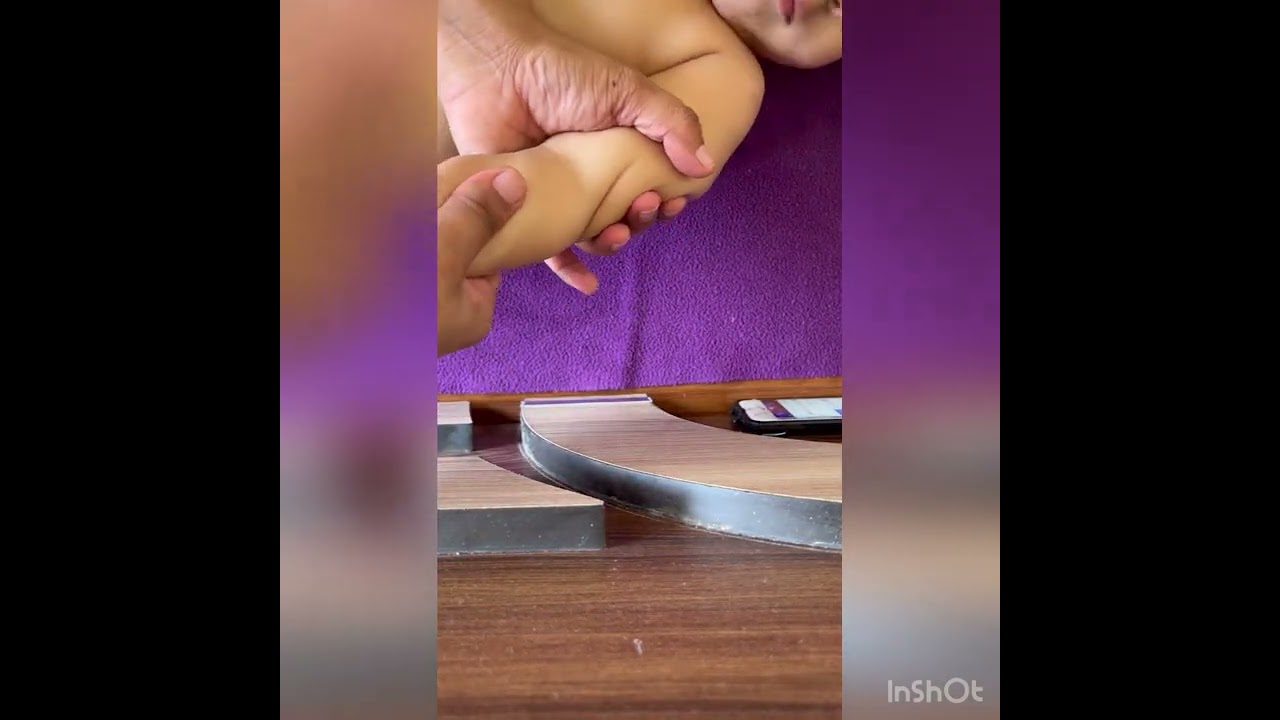 Exercise for Erb’s palsy