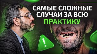 Самый сложный случай в практике разных стоматологов