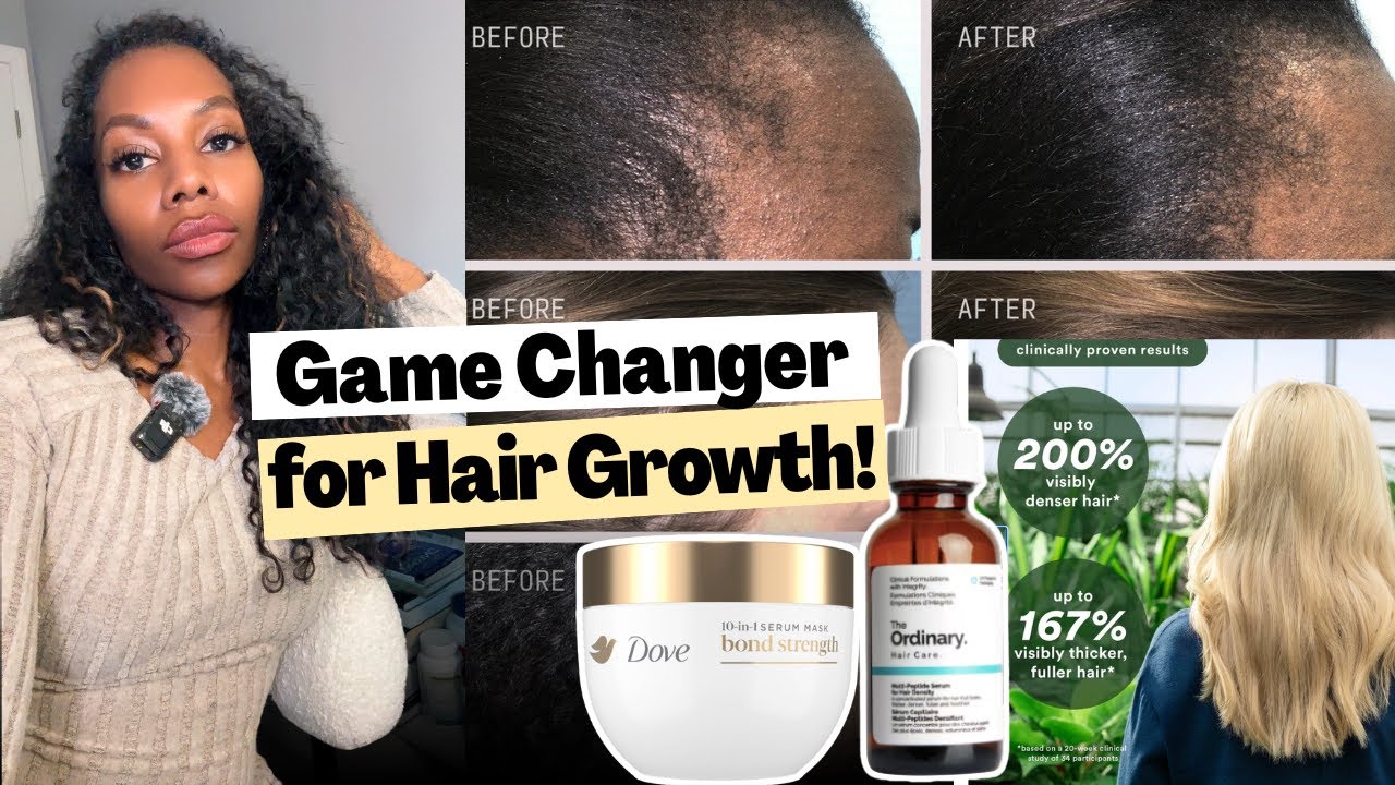 Если у вас выпадают волосы... вам нужны пептиды! Это не подлежит обсуждению! Вот почему...