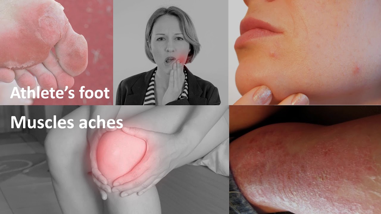 Ozonated Olive Oil Benefits