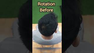 Neck Scar Tissue Rehab After Surgery 💆‍♂️ | Improve Cervical ROM &amp; Reduce Neck Pain