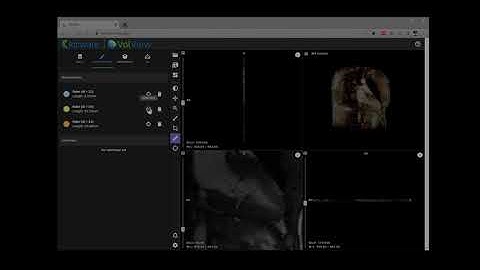 VolView: Radiological Measurements