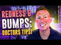 Adult acne? Redness & bumps? Could be rosacea #shorts