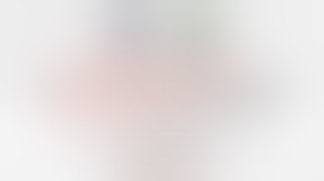 Right trisectionectomy with hilar and caudate lobe resection for perihilar Cholangiocarcinoma.