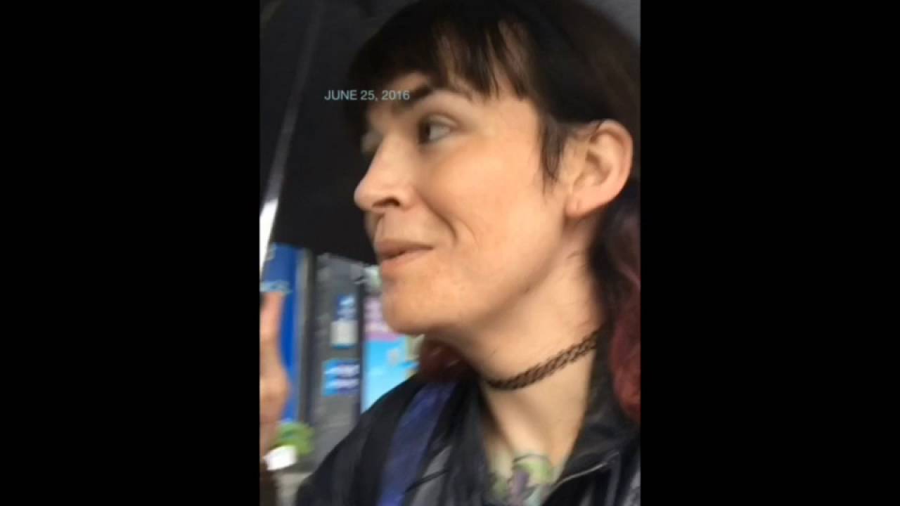 YESON Voice Center VFS voice feminization surgery- before + one month recovery