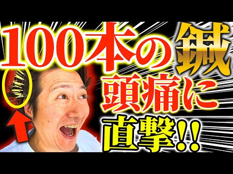 【頭痛　驚愕の100本鍼！？】マジ？100本の鍼で頭痛が治る？！いや〇本がいいでしょ、、、鍼バイキングでどっちがいいか体験してみた