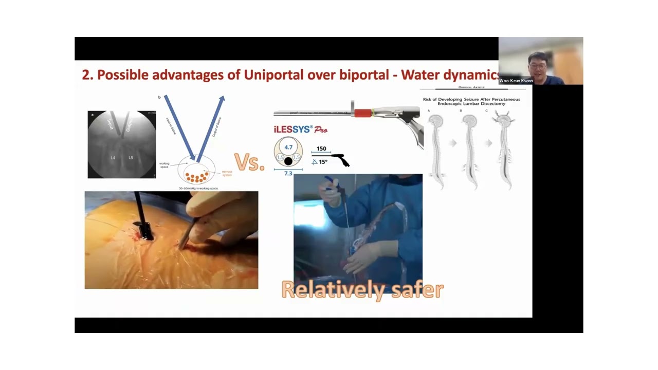 Uniportal vs biportal spinal endoscopy, SEAS webinar 