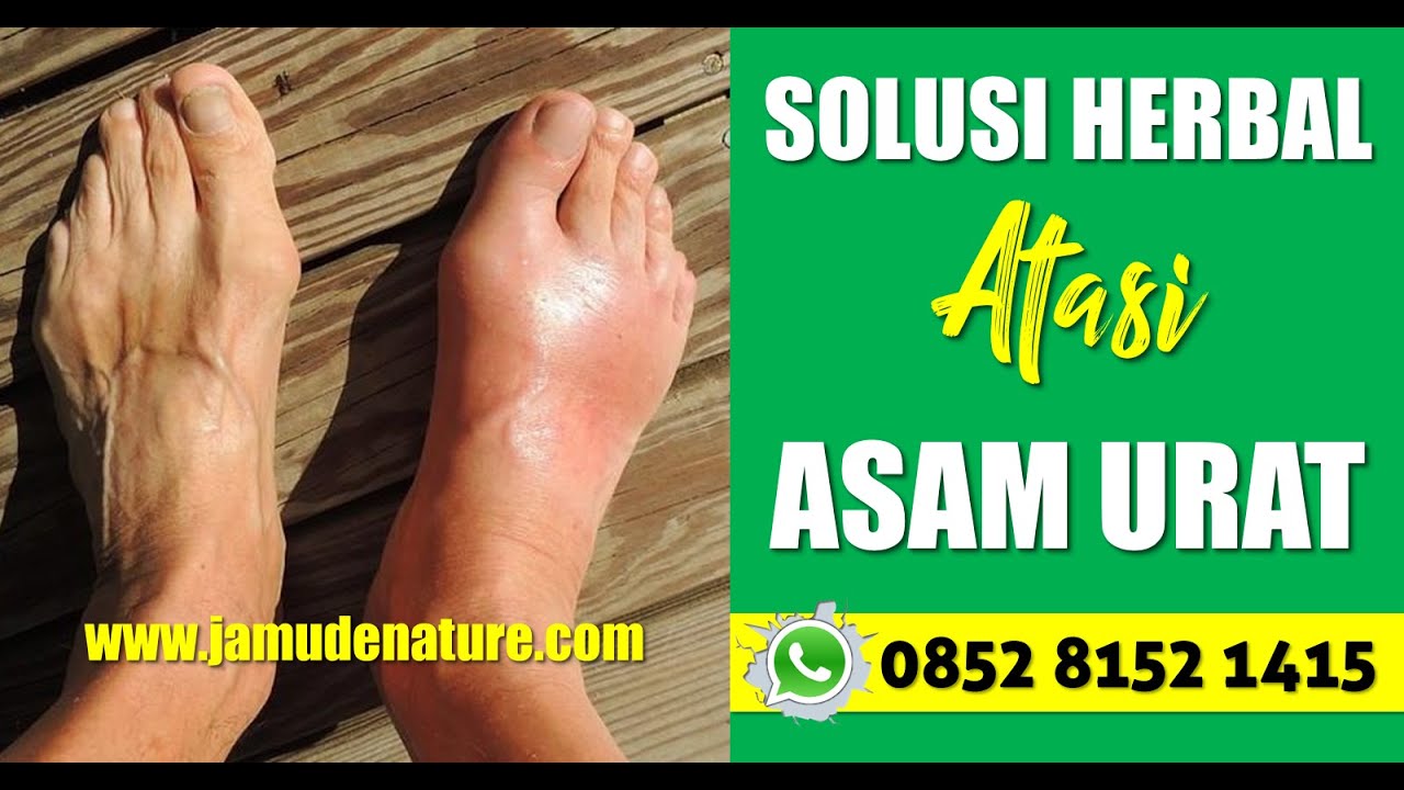 OBAT ASAM URAT ALAMI DE NATURE INDONESIA YouTube