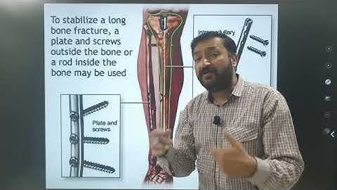 Physics O Level / IGCSE: Thermal Physics Lecture 4 by Sumair Sajjad