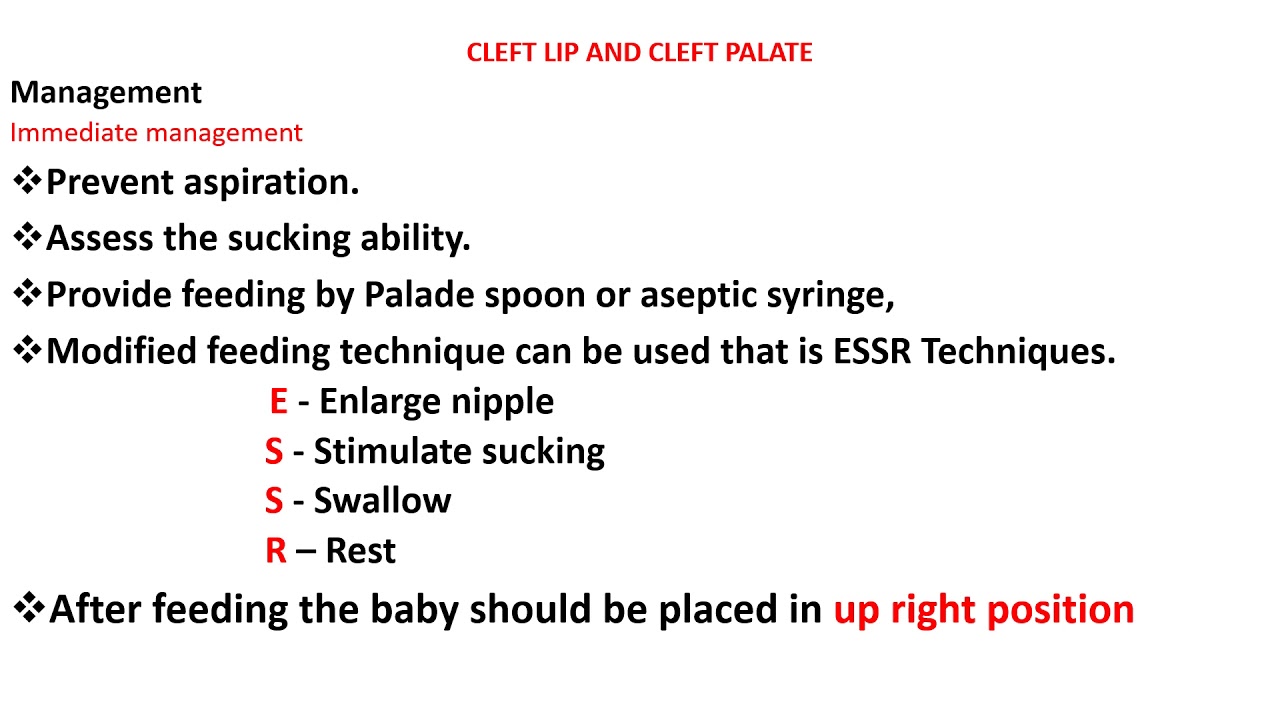 cleft lip and cleft palate and its management - YouTube