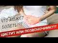 КАК ОТЛИЧИТЬ БОЛЬ В ПОЗВОНОЧНИКЕ ОТ ЦИСТИТА и что делать?