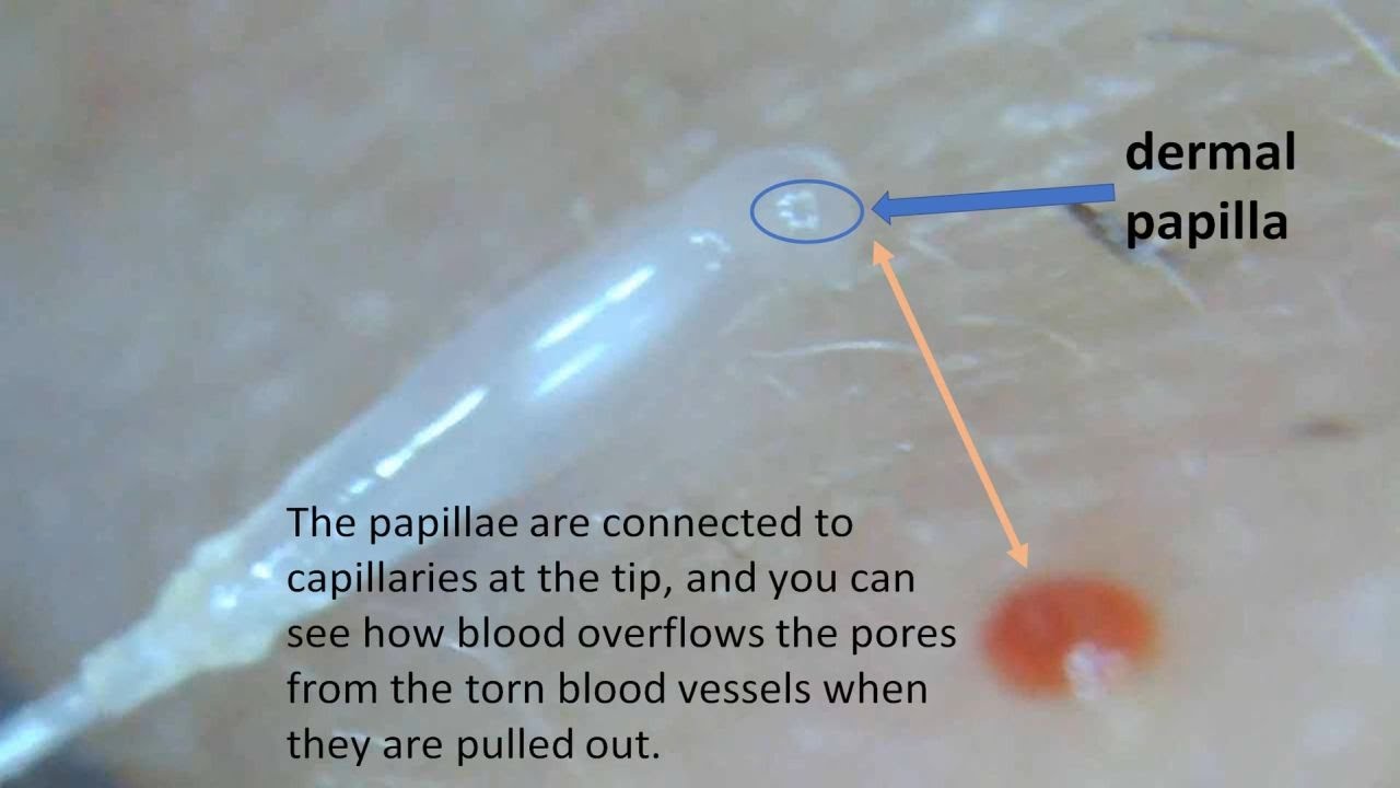 Where Is The Dermal Root Sheath Where Is The Dermal Root Sheath