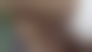 DISSECTION OF FRONT OF THIGH PART-2 BY DR MITESH DAVE