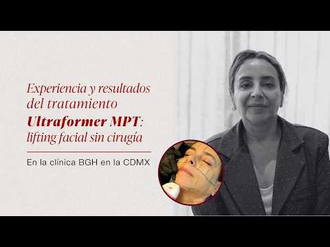 Experiencia y resultados del tratamiento Ultraformer MPT: lifting facial sin cirugía | Clínica BGH