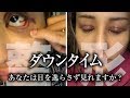 【 二重全切開 】高額 二重 整形 の ダウンタイム の 記録 をお見せします。【 整形完了 】