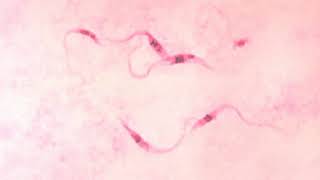 Kinetoplastea | Wikipedia audio article