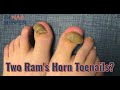 Ram's Horn Toenail, Are You Excited? (2020)