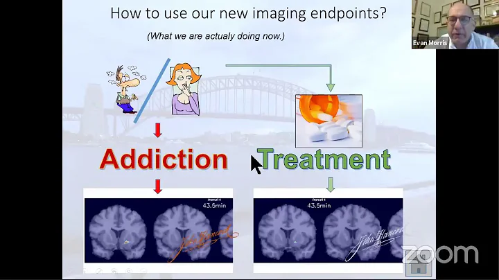 Faculty Forum Online, Alumni Edition: The Addicted Brain