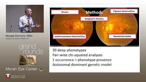 Thinking Deeply: Examining Deep Genotype-Phenotype Associations in Age-Related Macular Degeneration