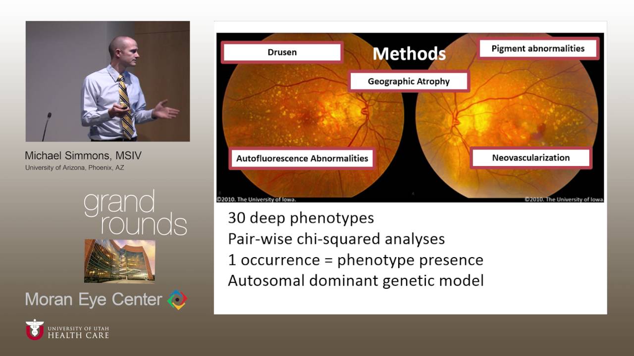Thinking Deeply: Examining Deep Genotype-Phenotype Associations in Age-Related Macular Degeneration http://clinicaltrials.gov