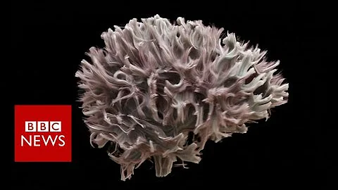 The most detailed scan of the wiring of the human brain - BBC News