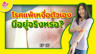 โรคแพ้เหงื่อตัวเอง มันมีอยู่จริงๆหรอ? | เคล็ดลับสุขภาพกับหมอยา EP. 37