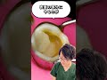 虫歯治療について解説します。#虫歯治療#歯医者#しん治歯科
