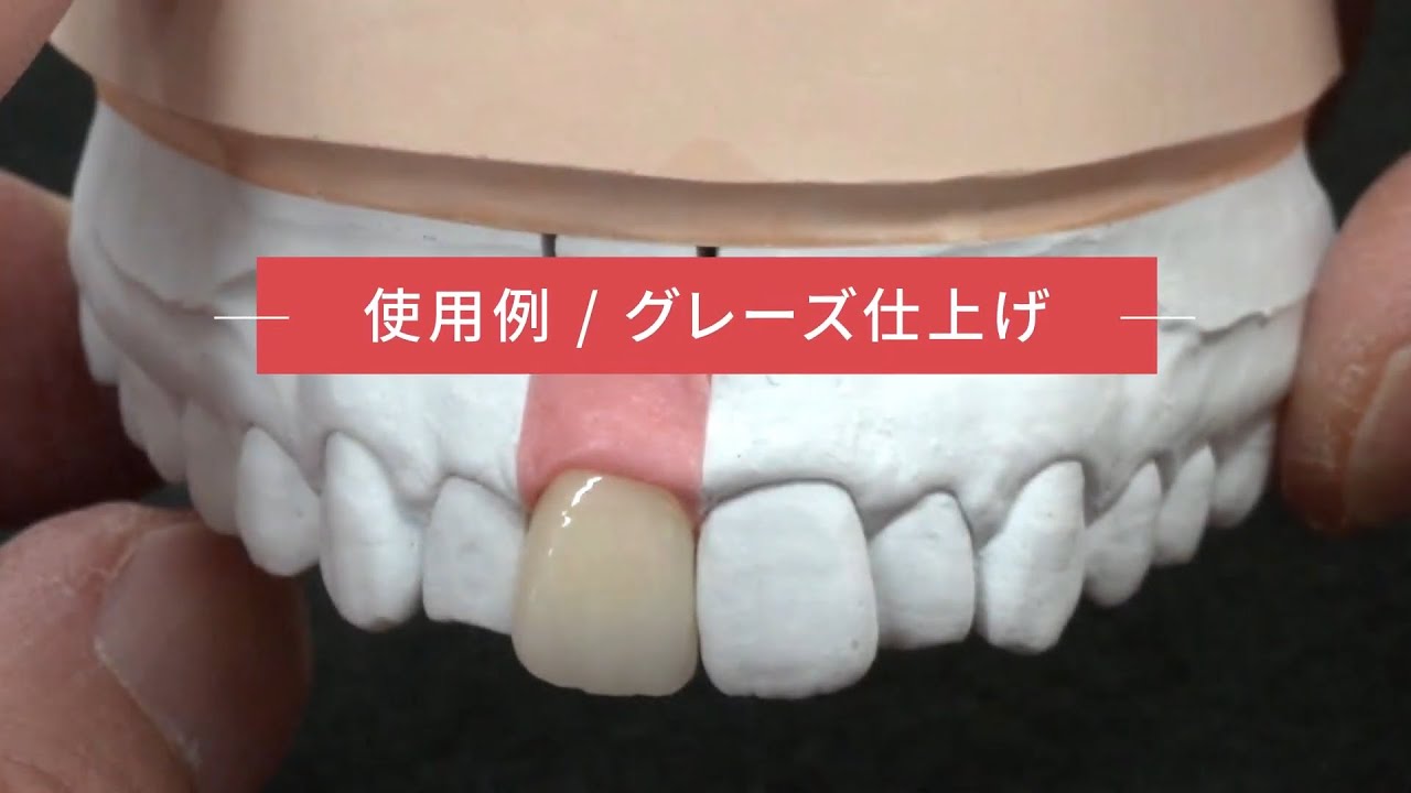 歯科技工　ZEO CE LIGHT 陶材筆コリンスキー　スライド蓋 qa028_zeo-460x307.png
