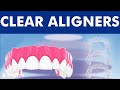 Clear Aligners without braces - Invisible orthodontics ©