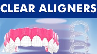 INVISALIGN  Orthodontic treatment with CLEAR ALIGNERS ©