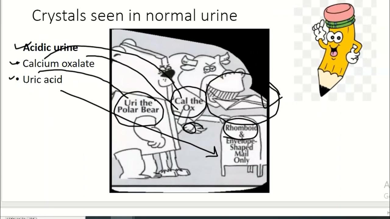 RememberNormal Crystals Acidic Urinealkaline Urine YouTube