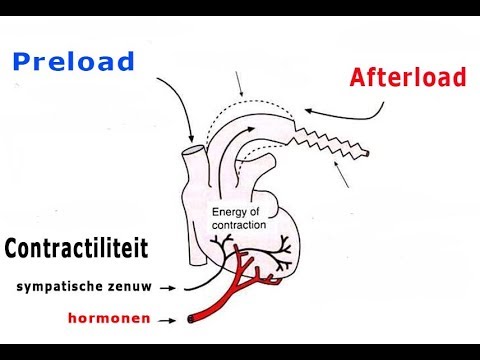 Video: Verschil Tussen Preload En Afterload