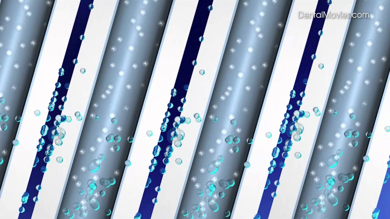 How does a compressor work? - animation. Dürr Dental.